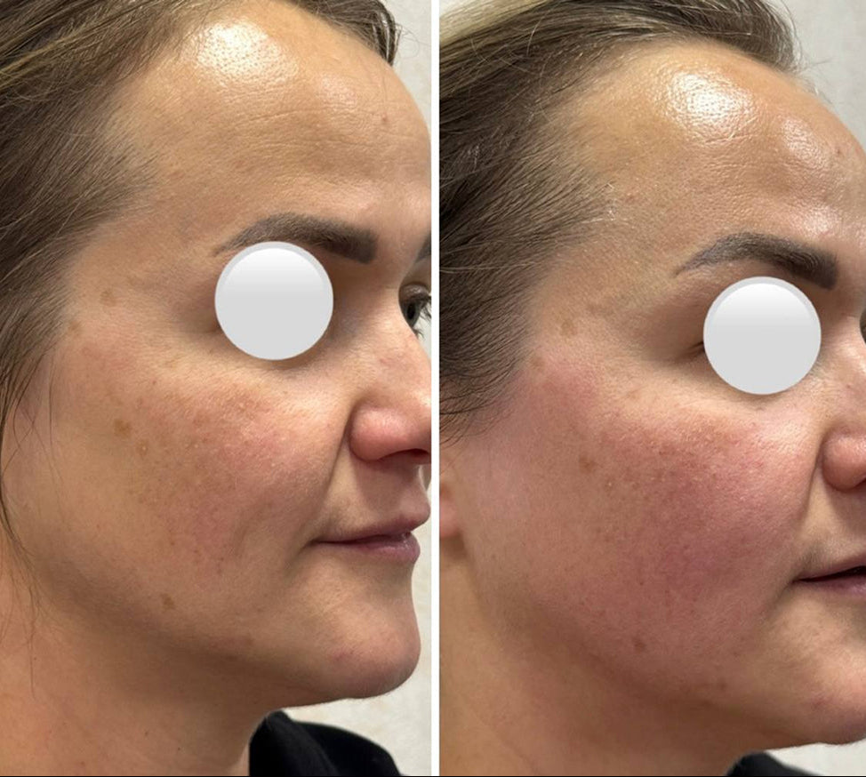 Moters veido palyginimas prieš ir po masažo, rodantis masažo poveikį