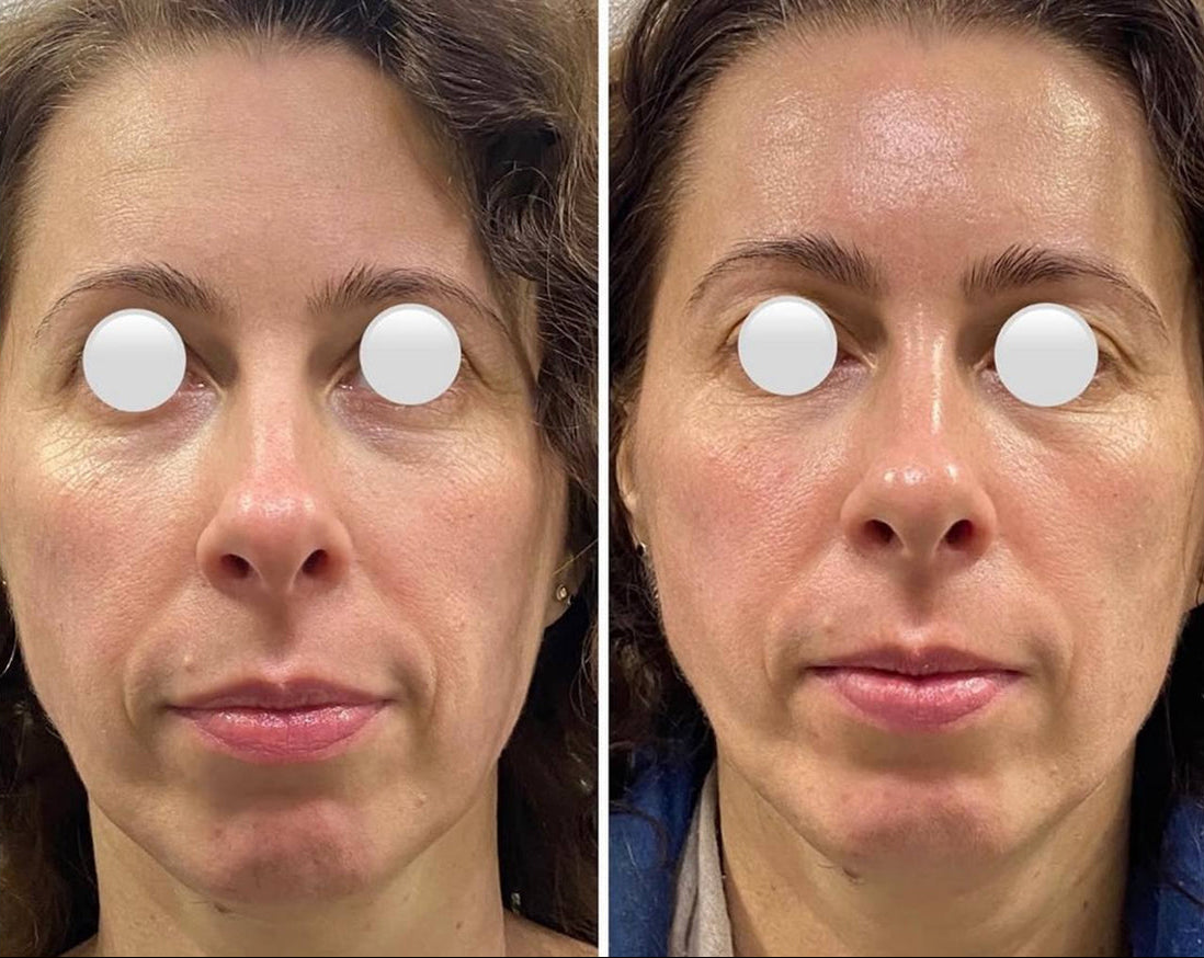 Moters veido palyginimas prieš ir po masažo, rodantis masažo poveikį